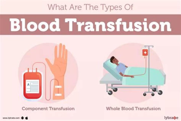 How much does a plasma transfusion cost?