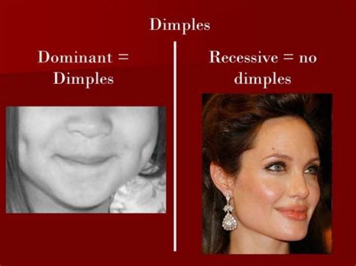 What determines whether a person will have dimples or not?